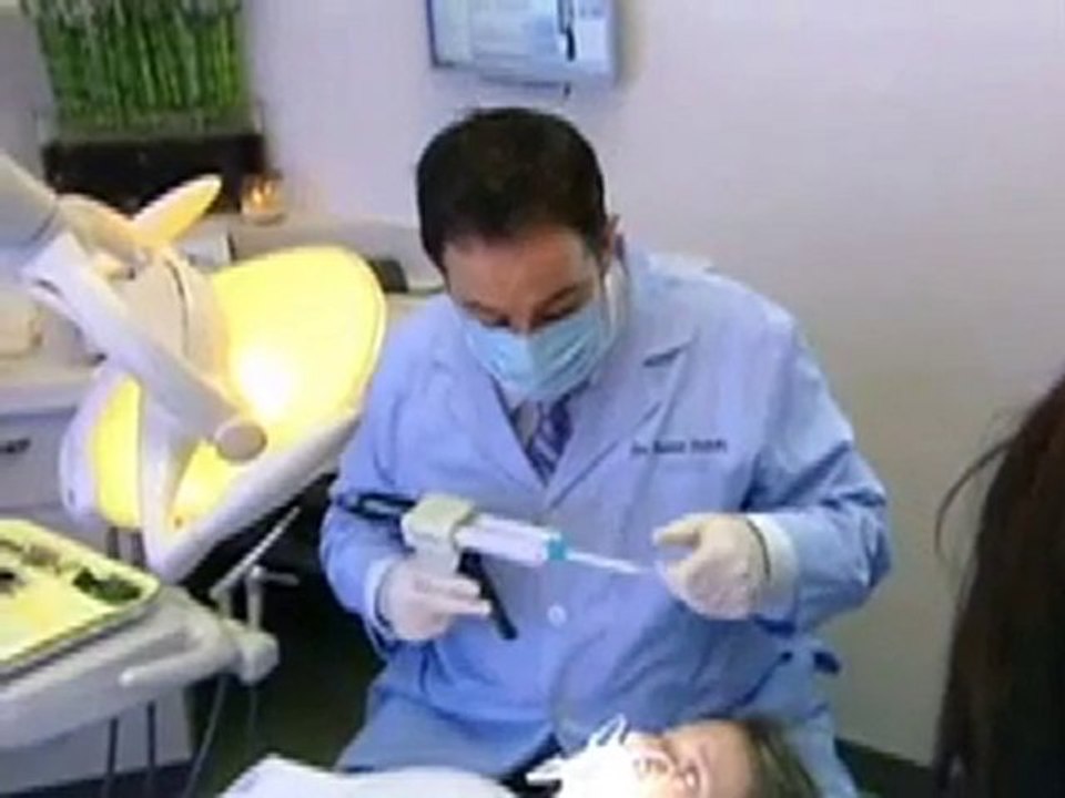 Porcelain Veneers & Teeth Whitening Patient Beverly Hills