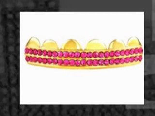 Buy Gold Teeth Grillz Online