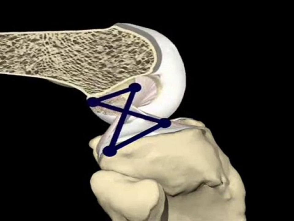 Video Demostrativo Nº1 de Movimiento de Rodilla