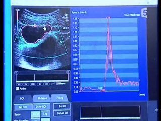 histoire de l'imagerie medicale (2)