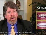 Porcelain Crowns, Dental Bridges – Restorative Dentistry