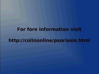 psoriasis treatment cure