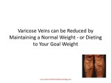 Varicose Vein Treatments and Laser Spider Vein Removal Expl