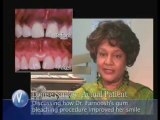 Testimonials - Los Angeles Smile Makeover Patients