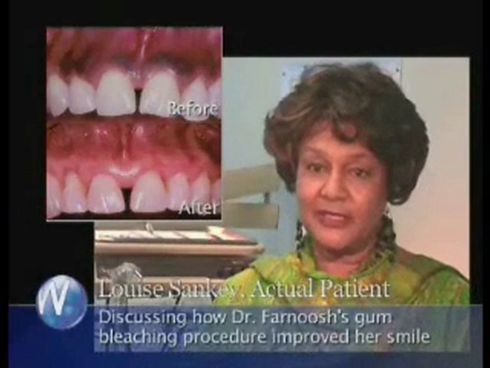 Testimonials - Los Angeles Smile Makeover Patients