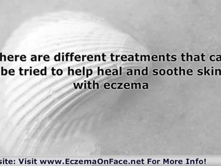 Eliminating Eczema Is Easy!