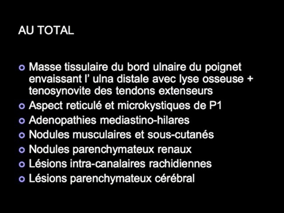QUIZZ Imagerie des Extrémités - Réponses (2/2)