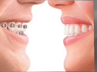 Oxford dentist explains why veneers are so popular