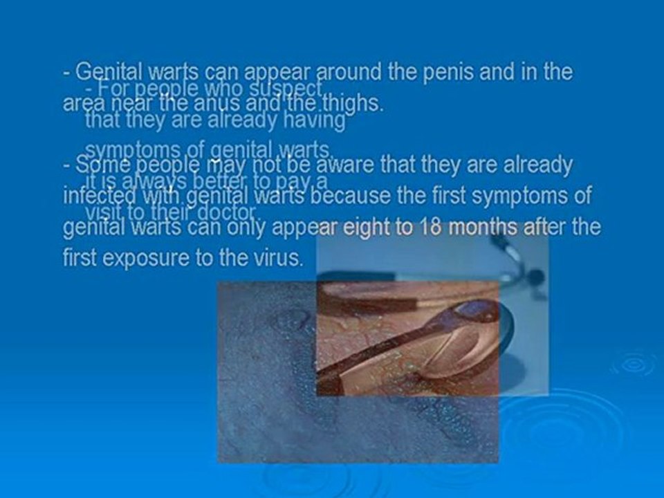 How To Get Rid of Genital Warts