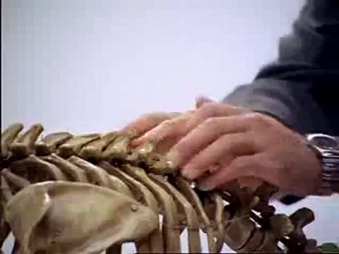 Chiropractic care Union City - Milpitas Spine Center Video