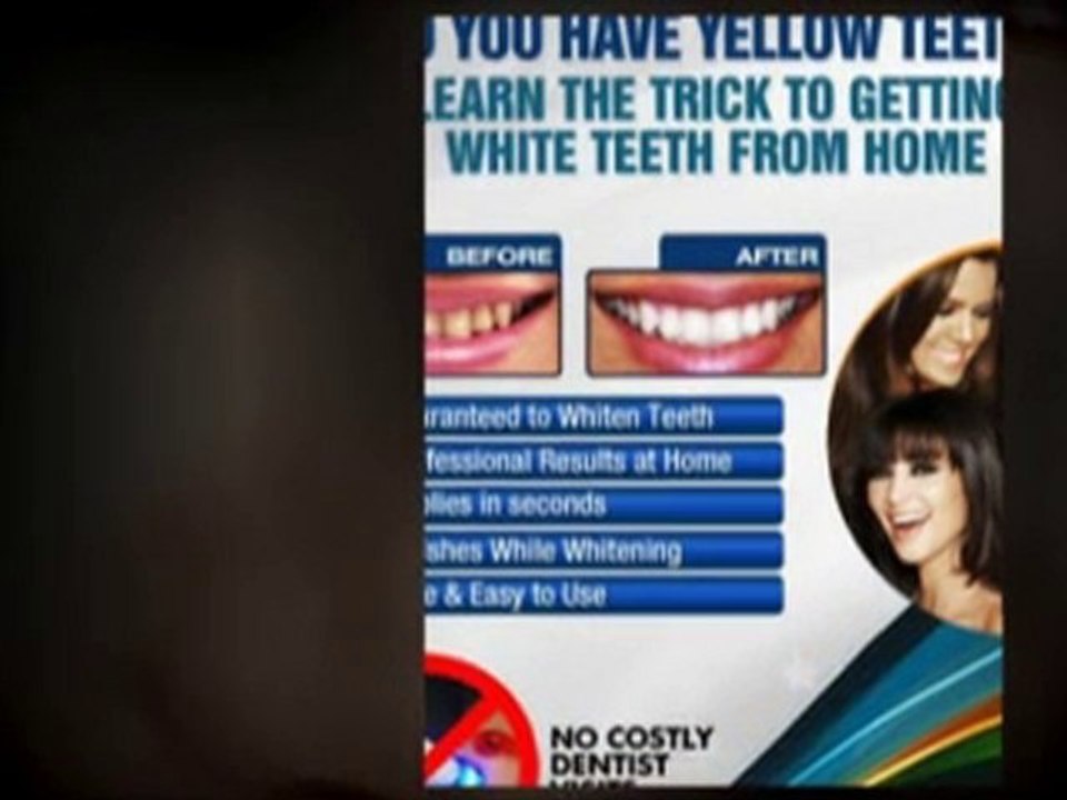 Use Idol Whitener for a Spectacular Smile!