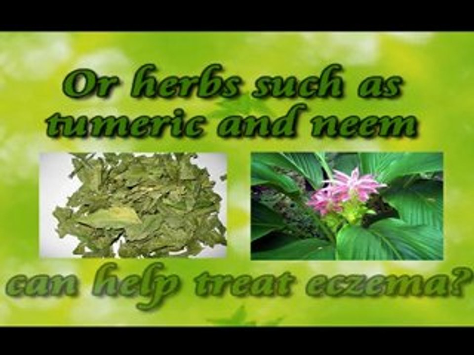 Is Your Child Having Eczema?
