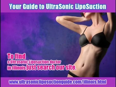 Find a Ultrasonic Liposuction doctor in Illinois.