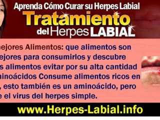 Video herunterladen: Como Curar Herpes Labial - Tratamiento del Herpes Labial