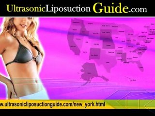 Ultrasonic Liposuction New York