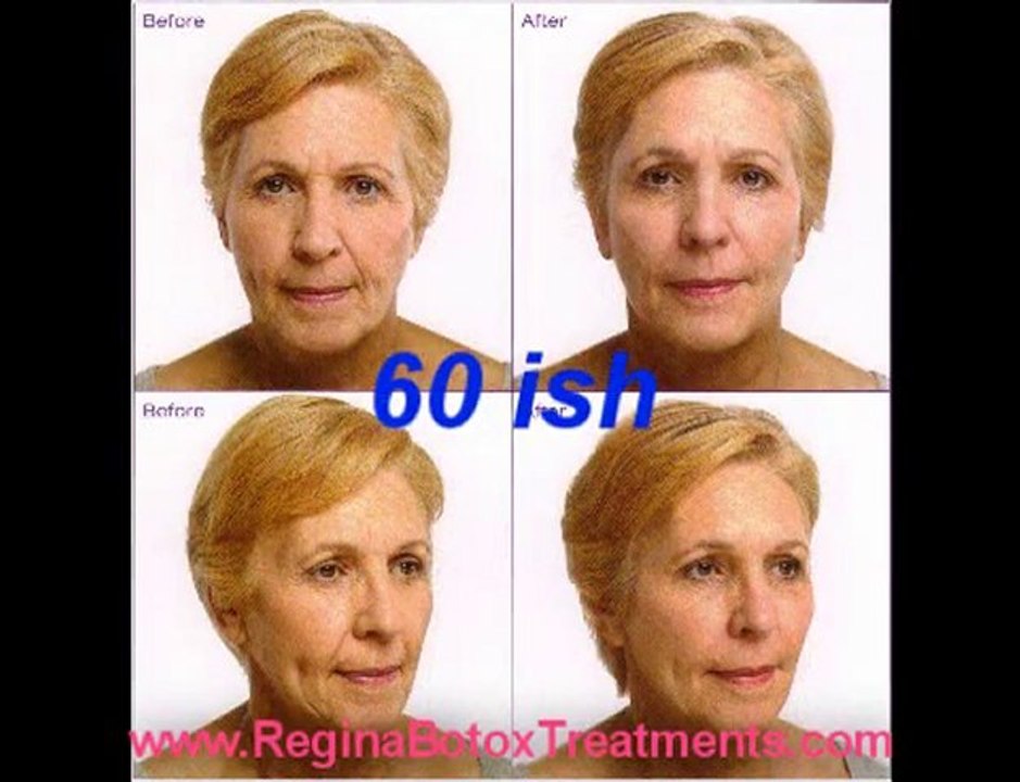 ReginaBotoxTreatments.com