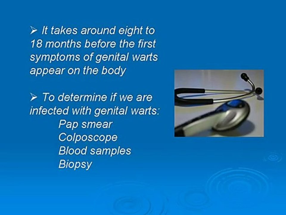 Several Ways of Curing Genital Warts