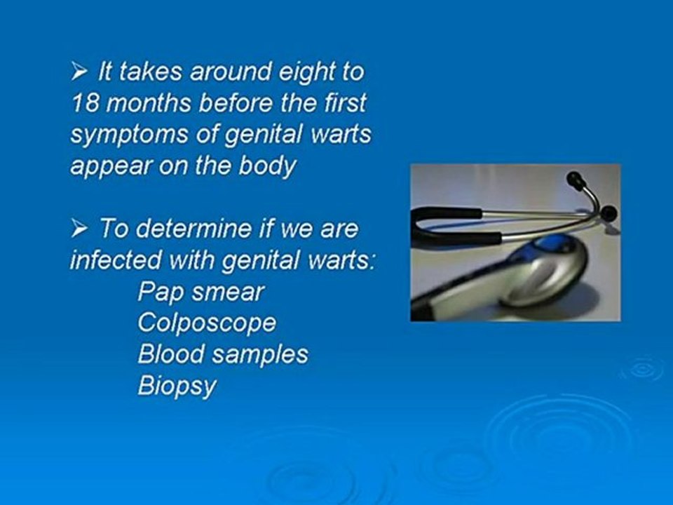 Several Treatments for Genital Warts