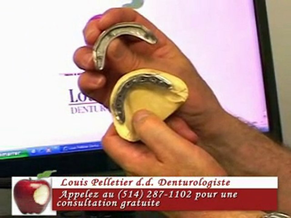 Implants Dentaires Montreal