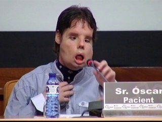 World's first full face transplant man appears on TV