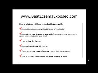 Beat Eczema - is this a natural eczema treatment?