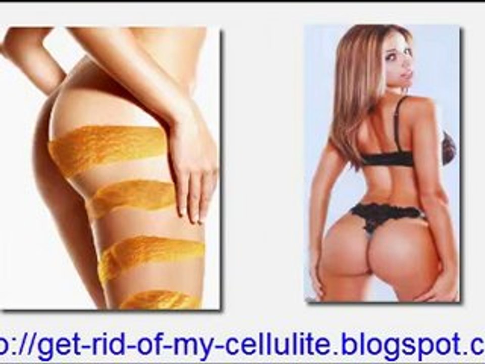 Learn how to get rid of cellulite on the Thighs, Legs, Butt