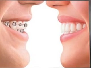 Oxford dentist explains why veneers are popular at dentistr