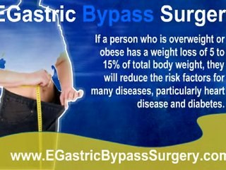 Gastric Bypass Surgery