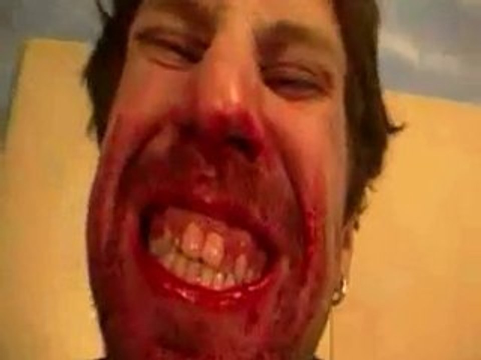 smashed in the face4