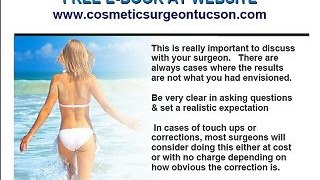 What is the Risk of Plastic or Cosmetic Surgery, Tucson AZ
