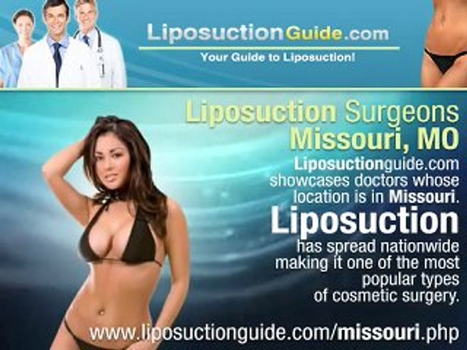Liposuction Missouri