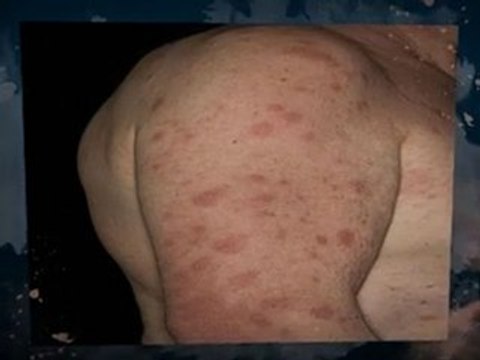 Black Mold Removal Forest City FL 407