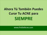 Ahora puedes Desaparecer el ACNE para siempre!