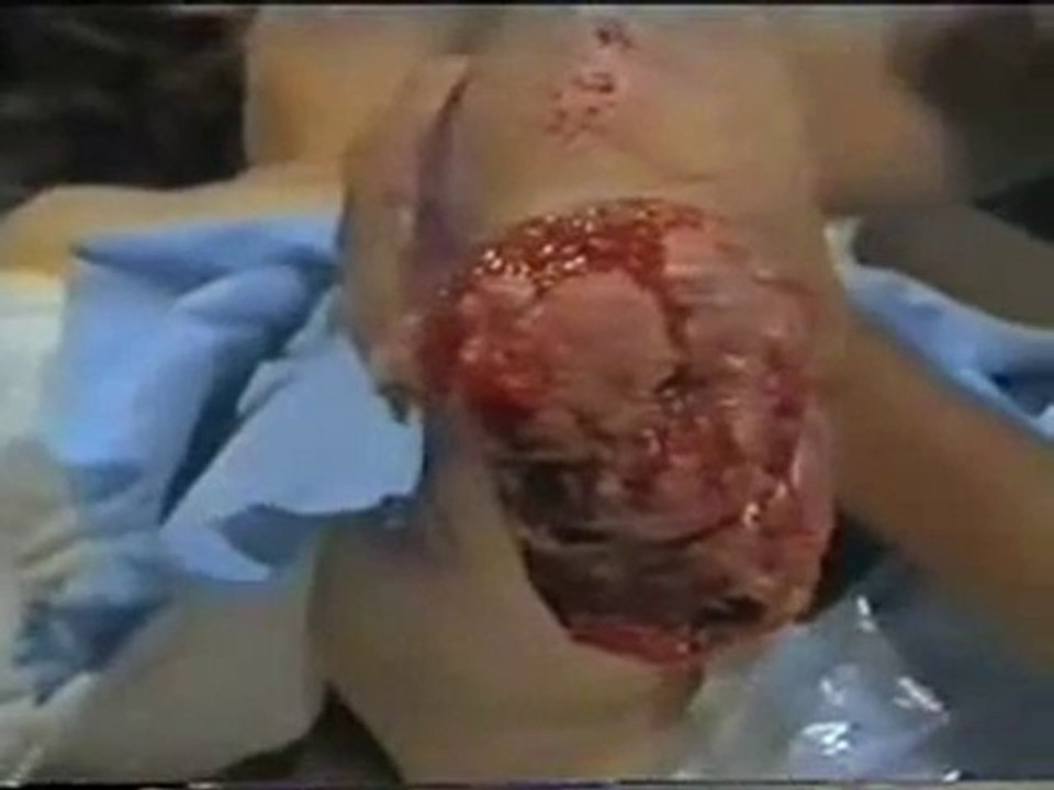 War_surgery_part_1