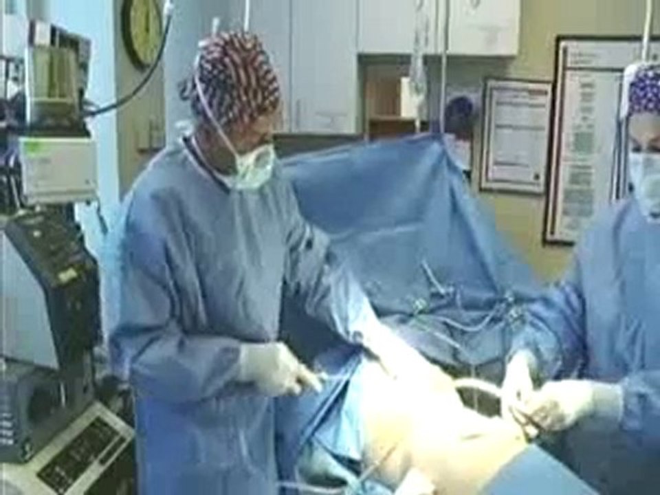 Gynecomastia Surgery - Plastic Surgery Information