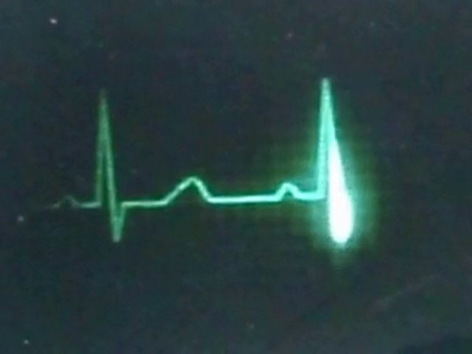 Mécanique des fluides