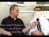 Oral Surgery - Bone Considerations