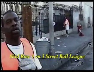 The Community is Outraged / Operation Face-Lift