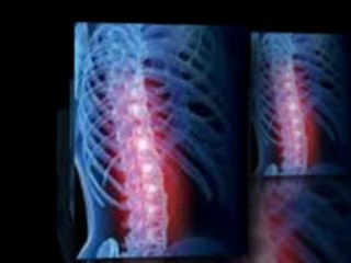 Tucson Chiropractor - 3 Causes of Neck Pain