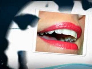 Mauvaise haleine que faire ?