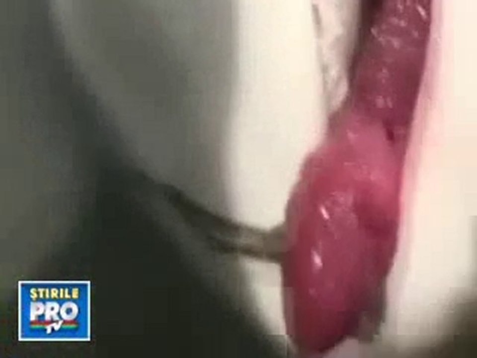 A MUST SEE:SHARK WITH WHAT LOOKS LIKE A PENIS IN IT'S ...