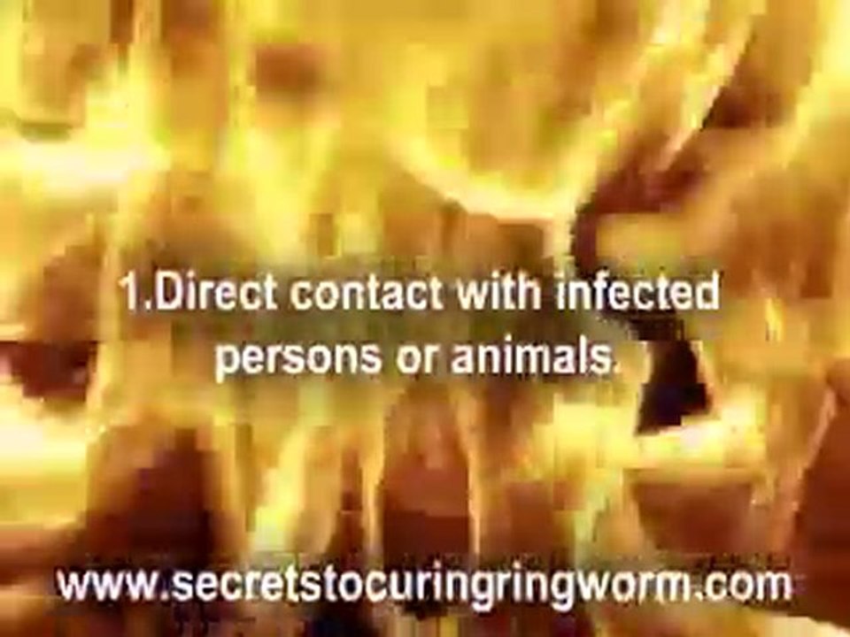 Ringworm Spreads Like fire