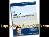 Lupus Cure - Discover th Best Guide Cure Lupus Digital Info!