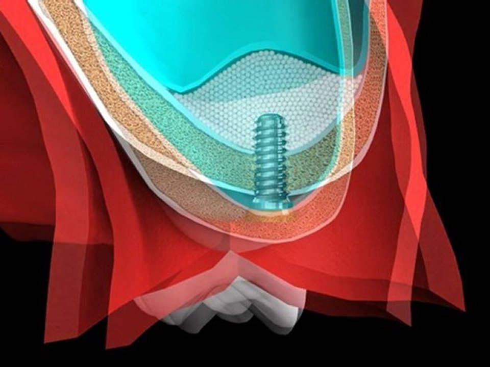 Mr.Curette Co's Sinus Master