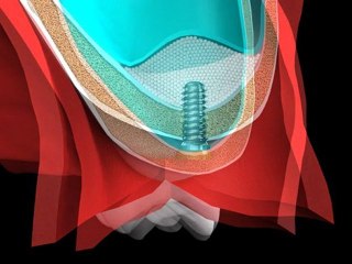 Mr.Curette Co's Sinus Master