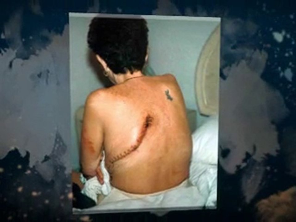 Asbestos Removal North De Land FL 386