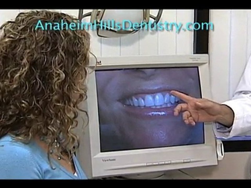 Anaheim Hills Best Dentist-cosmetic-laser-dentistry