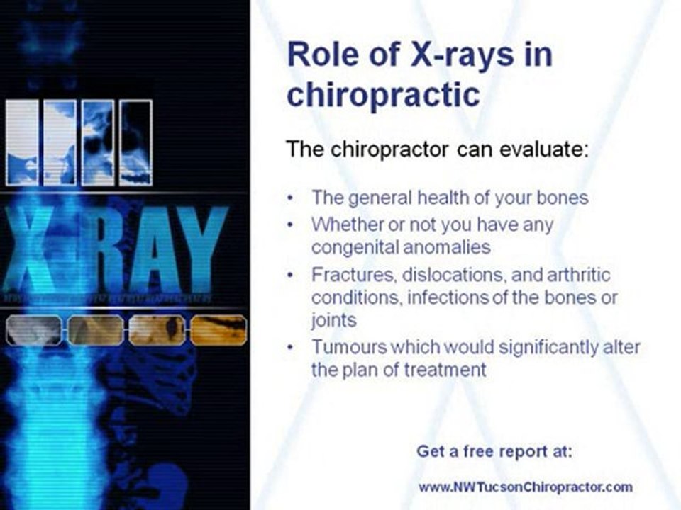 Why do Chiropractors use Xrays?