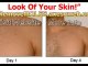 LEARN End Skin Moles in 3 Days | Remove Moles NOW!