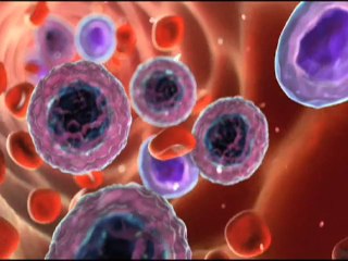 Living with chronic myeloid leukemia